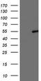 Lipoprotein Lipase antibody, CF503787, Origene, Western Blot image 