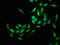 Enhancer of mRNA-decapping protein 4 antibody, LS-C671864, Lifespan Biosciences, Immunofluorescence image 