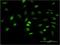 LPR2BP antibody, H00353322-M02, Novus Biologicals, Immunocytochemistry image 
