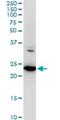Vesicle-trafficking protein SEC22b antibody, H00009554-M03, Novus Biologicals, Western Blot image 