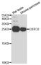 Glutathione S-Transferase Omega 2 antibody, TA332906, Origene, Western Blot image 