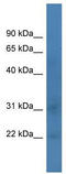 TATA-Box Binding Protein Associated Factor 12 antibody, TA329242, Origene, Western Blot image 