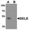 DAP3 Binding Cell Death Enhancer 1 antibody, A31772, Boster Biological Technology, Western Blot image 