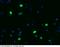pp120 antibody, 50571-R117, Sino Biological, Immunohistochemistry paraffin image 