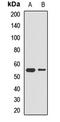Pep4 antibody, LS-C668099, Lifespan Biosciences, Western Blot image 