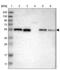 Zinc Finger Protein 70 antibody, PA5-53854, Invitrogen Antibodies, Western Blot image 