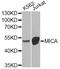 MHC Class I Polypeptide-Related Sequence A antibody, LS-C747715, Lifespan Biosciences, Western Blot image 