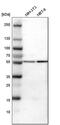 ATPase H+ Transporting V1 Subunit B2 antibody, PA5-52518, Invitrogen Antibodies, Western Blot image 