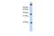 Single-stranded DNA-binding protein 3 antibody, GTX45295, GeneTex, Western Blot image 