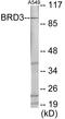 Bromodomain Containing 3 antibody, EKC1816, Boster Biological Technology, Western Blot image 