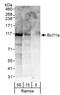 BAF Chromatin Remodeling Complex Subunit BCL11A antibody, A300-380A, Bethyl Labs, Western Blot image 
