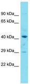 Prostaglandin E Synthase 2 antibody, TA329982, Origene, Western Blot image 