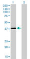 NK2 Homeobox 5 antibody, LS-C196993, Lifespan Biosciences, Western Blot image 