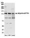 Aftiphilin antibody, A304-953A, Bethyl Labs, Western Blot image 