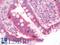 Motile Sperm Domain Containing 1 antibody, LS-B10091, Lifespan Biosciences, Immunohistochemistry paraffin image 