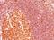 MALT1 Paracaspase antibody, orb387967, Biorbyt, Immunohistochemistry paraffin image 