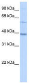 Methyltransferase Like 2B antibody, TA346799, Origene, Western Blot image 