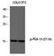 Astrocytic phosphoprotein PEA-15 antibody, MBS9404426, MyBioSource, Western Blot image 