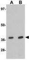EI24 Autophagy Associated Transmembrane Protein antibody, GTX31841, GeneTex, Western Blot image 