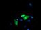 Ribophorin I antibody, MA5-25710, Invitrogen Antibodies, Immunocytochemistry image 