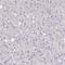 Carnosine Synthase 1 antibody, HPA038569, Atlas Antibodies, Immunohistochemistry paraffin image 