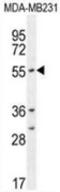 Cytochrome P450 Family 2 Subfamily A Member 7 antibody, AP51169PU-N, Origene, Western Blot image 