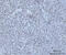 High Mobility Group Nucleosomal Binding Domain 2 antibody, A04839-2, Boster Biological Technology, Immunohistochemistry paraffin image 