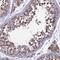 Ring Finger Protein 17 antibody, NBP1-83783, Novus Biologicals, Immunohistochemistry paraffin image 