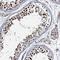 Zinc Finger Protein 609 antibody, NBP1-92634, Novus Biologicals, Immunohistochemistry frozen image 