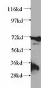 Eukaryotic Translation Elongation Factor 1 Delta antibody, 60085-2-Ig, Proteintech Group, Western Blot image 