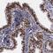 ERH MRNA Splicing And Mitosis Factor antibody, HPA002567, Atlas Antibodies, Immunohistochemistry frozen image 