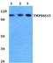 Transmembrane Serine Protease 15 antibody, A11114, Boster Biological Technology, Western Blot image 
