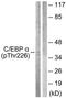 CCAAT/enhancer-binding protein alpha antibody, TA312952, Origene, Western Blot image 