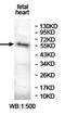 Ankyrin Repeat Domain 13D antibody, orb78055, Biorbyt, Western Blot image 