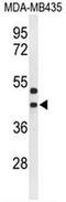Uracil nucleotide/cysteinyl leukotriene receptor antibody, AP51923PU-N, Origene, Western Blot image 