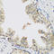 HR1 antibody, LS-C331298, Lifespan Biosciences, Immunohistochemistry paraffin image 