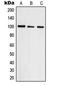 DNA Topoisomerase III Beta antibody, LS-C353109, Lifespan Biosciences, Western Blot image 