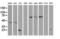 Ubiquitin Conjugating Enzyme E2 E3 antibody, LS-C797581, Lifespan Biosciences, Western Blot image 