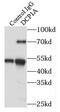 Decapping MRNA 1A antibody, FNab02269, FineTest, Immunoprecipitation image 