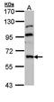 Mannosyl (Beta-1,4-)-Glycoprotein Beta-1,4-N-Acetylglucosaminyltransferase antibody, orb69721, Biorbyt, Western Blot image 