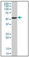 Fatty Acid Desaturase 1 antibody, AM31762PU-N, Origene, Western Blot image 