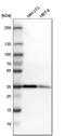 Twinfilin Actin Binding Protein 1 antibody, HPA018116, Atlas Antibodies, Western Blot image 