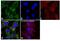 Isocitrate Dehydrogenase (NADP(+)) 2, Mitochondrial antibody, MA5-17271, Invitrogen Antibodies, Immunofluorescence image 