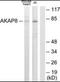 A-Kinase Anchoring Protein 8 antibody, orb96495, Biorbyt, Western Blot image 