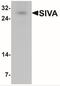 SIVA1 Apoptosis Inducing Factor antibody, NBP2-41150, Novus Biologicals, Western Blot image 
