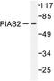 Protein Inhibitor Of Activated STAT 2 antibody, LS-C176342, Lifespan Biosciences, Western Blot image 