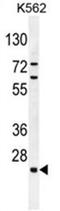 Chromosome 15 Open Reading Frame 41 antibody, AP50477PU-N, Origene, Western Blot image 