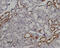Transient Receptor Potential Cation Channel Subfamily V Member 5 antibody, GTX54868, GeneTex, Immunohistochemistry paraffin image 