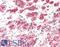 Egl-9 Family Hypoxia Inducible Factor 3 antibody, LS-B11948, Lifespan Biosciences, Immunohistochemistry paraffin image 
