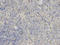 PYD And CARD Domain Containing antibody, A00362-2, Boster Biological Technology, Immunohistochemistry paraffin image 